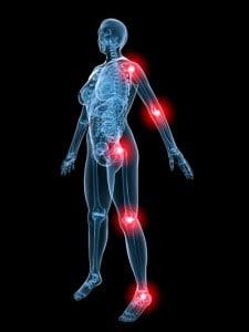 Bone & Joint Pain in MPN Patients Revealed
