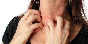 woman scratching her neck due to PV