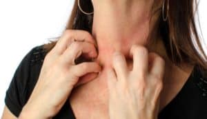 woman scratching her neck due to PV