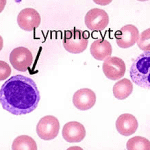 lymphocyte