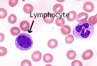 A key role for lymphoid cells in the pathology of myeloproliferative neoplasm