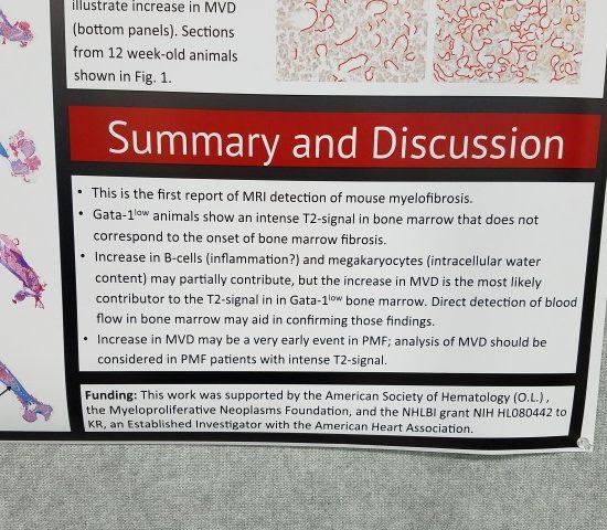 ASH 2016 poster2 conclusion