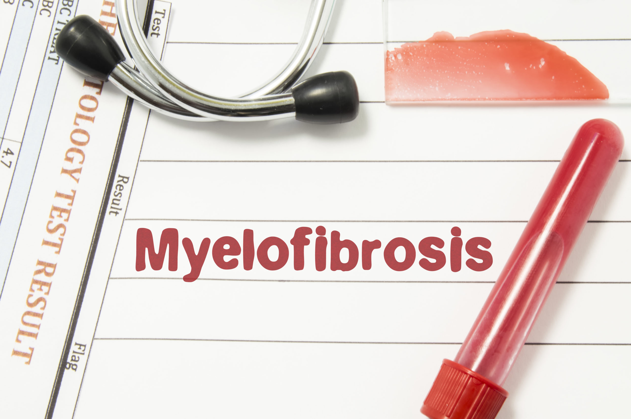 What is Primary Myelofibrosis