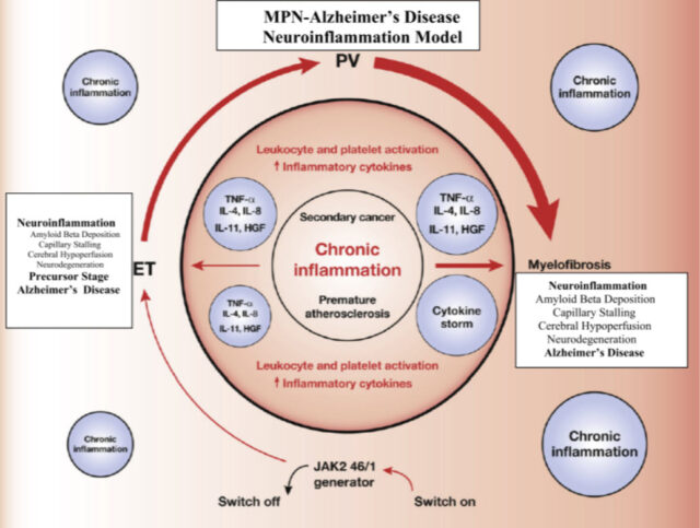 MPN's and Alzheimer's: Is there a connection? 1 MPN Alzheimers Disease neuroinflammation model
